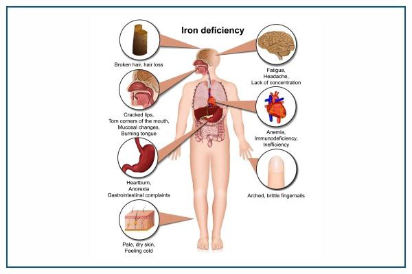 What Does Low Iron Mean In Blood Work